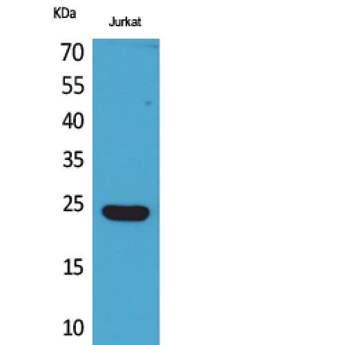 Polyclonal Rabbit anti-Human IFNE / Interferon Epsilon Antibody (151-200 aa, C-terminal, WB)