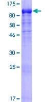 Human DYNC1I1 Protein (Recombinant GST)