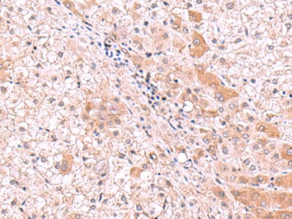 Polyclonal Rabbit anti-Human RIC8A Antibody (IHC)