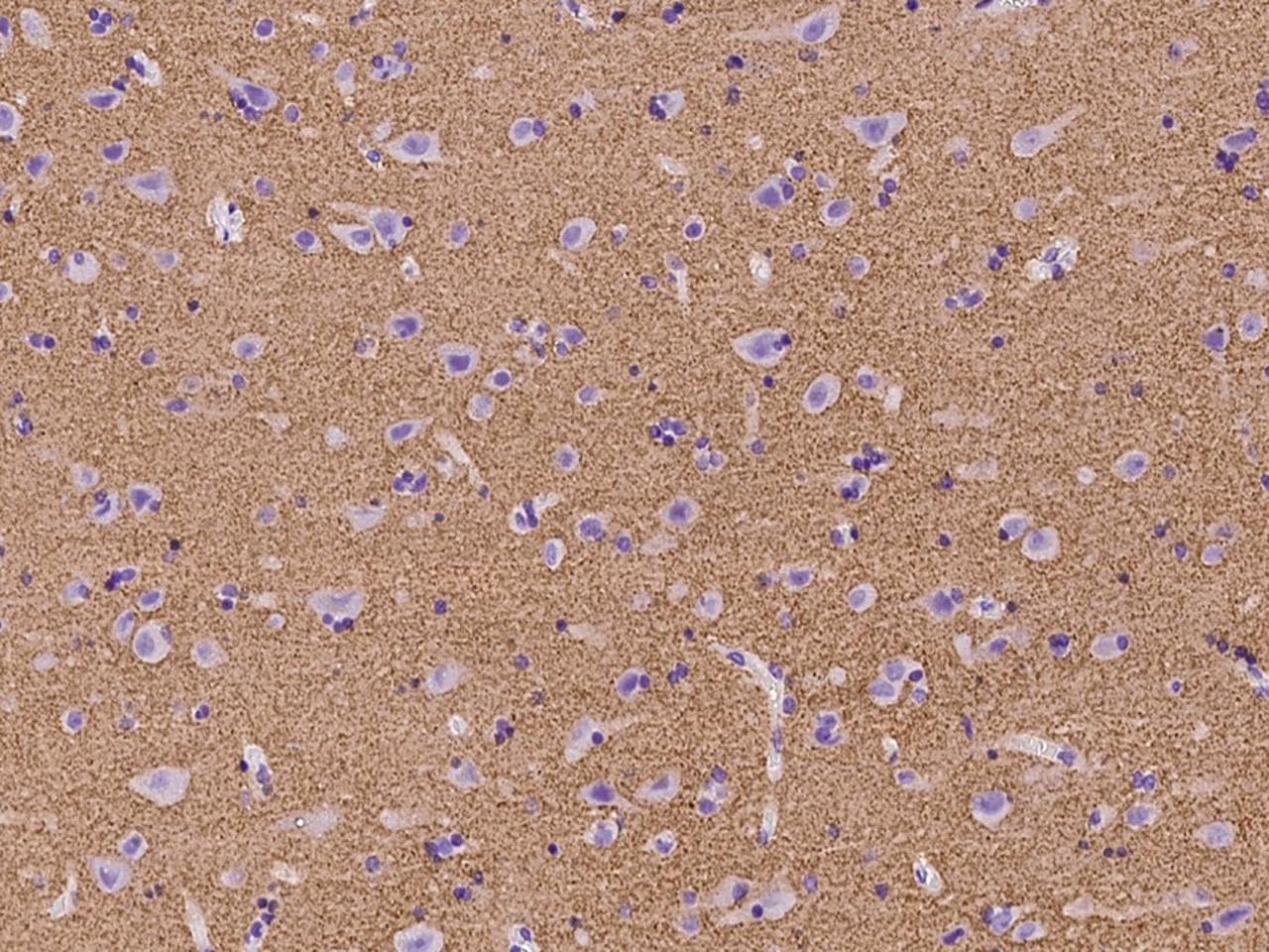 SYN3 / Synapsin III Antibody