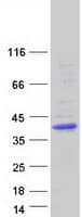 Human KCTD7 Protein (Recombinant Myc-DDK (Flag))