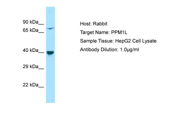 PPM1L Antibody (aa141-190)