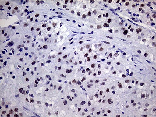 TSEN34 Antibody (clone OTI6B3)