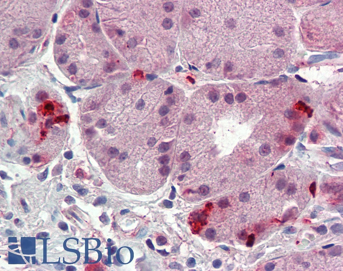 IHC-plus™ ITGA6/Integrin Alpha 6/CD49f Antibody (N-Terminus)