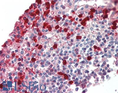 Polyclonal Rabbit anti-Human MMP9 / Gelatinase B Antibody (IHC, WB)