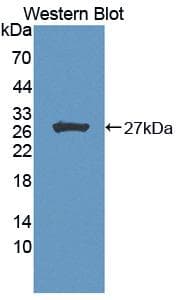HIPK2 Antibody (aa977-1198, FITC)