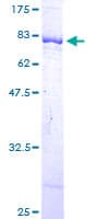 Human DARS Protein (Recombinant GST)