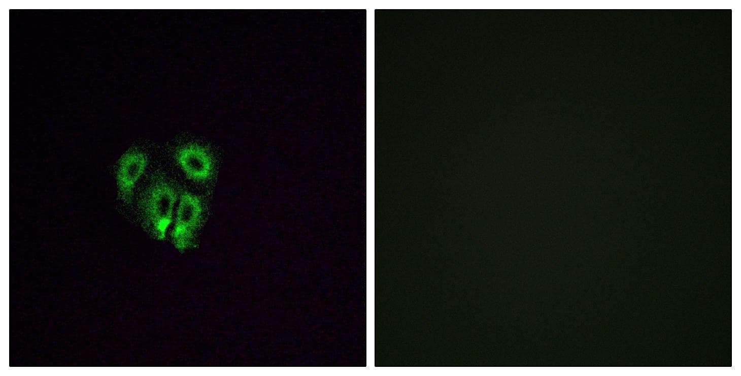 OR4F4 Antibody