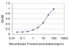 IHC-plus™ RPL4 / Ribosomal Protein L4 Antibody (clone 4A3)