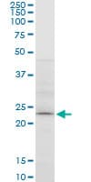 Monoclonal Mouse anti-Human APG5 / ATG5 Antibody (clone 1E7, WB)