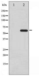 Polyclonal Rabbit anti-Human CDC25A Antibody (WB)