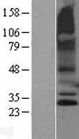 RNF182 Protein (Over-Expression Lysate Myc-DDK (Flag))
