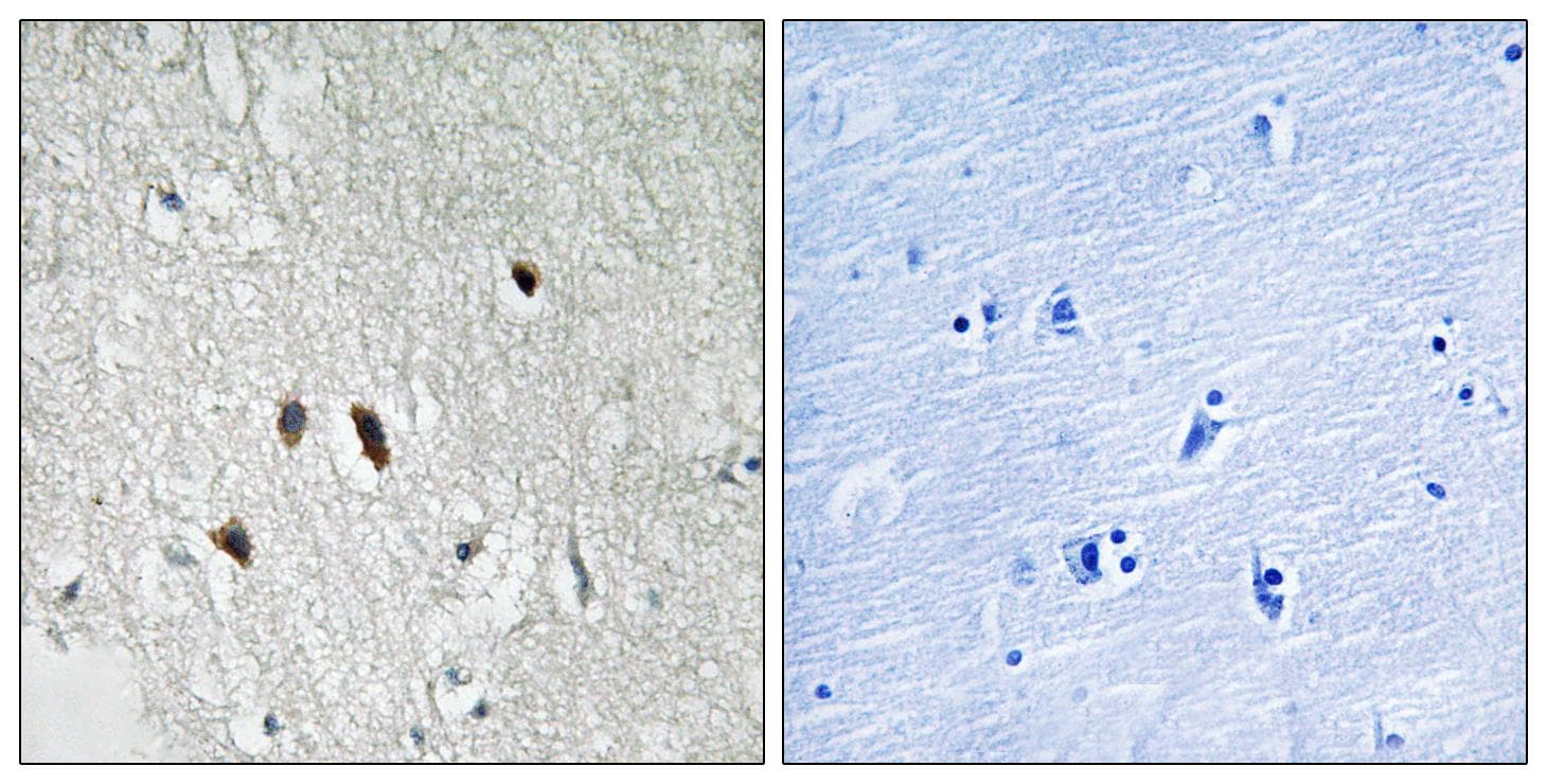 RICK / RIP2 Antibody (p176)