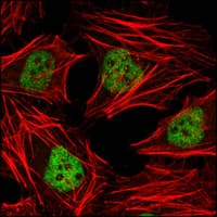 IHC-plus™ HDAC3 Antibody (clone 7G6C5)