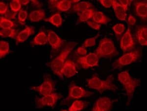 Polyclonal Rabbit anti-Human HSET / KIFC1 Antibody (IHC, IF, WB)