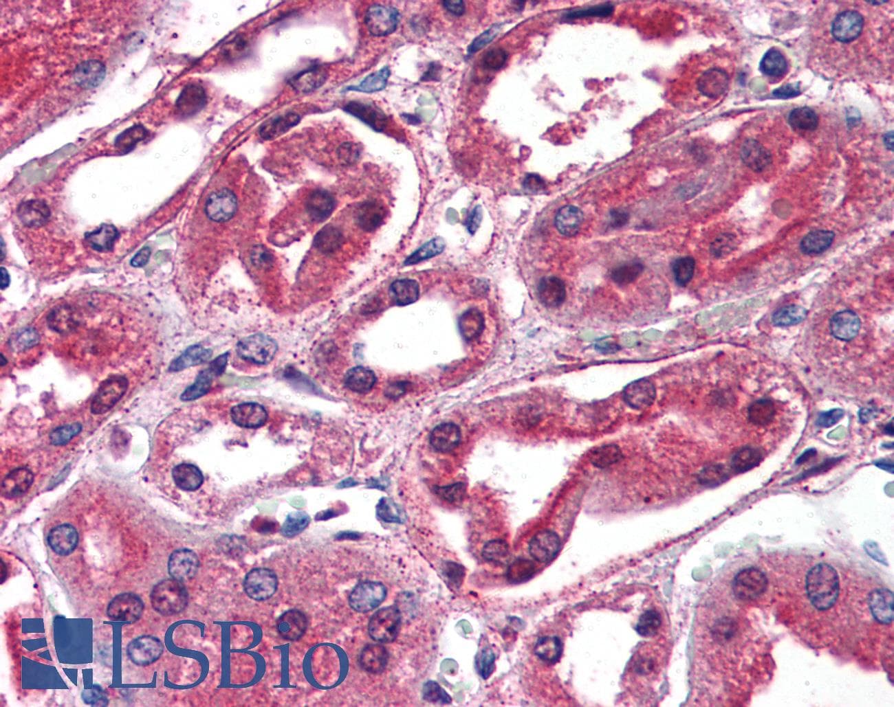 IHC-plus™ Polyclonal Rabbit anti-Human SCNN1G / ENaC Gamma Antibody (C-Terminus, IHC, WB)