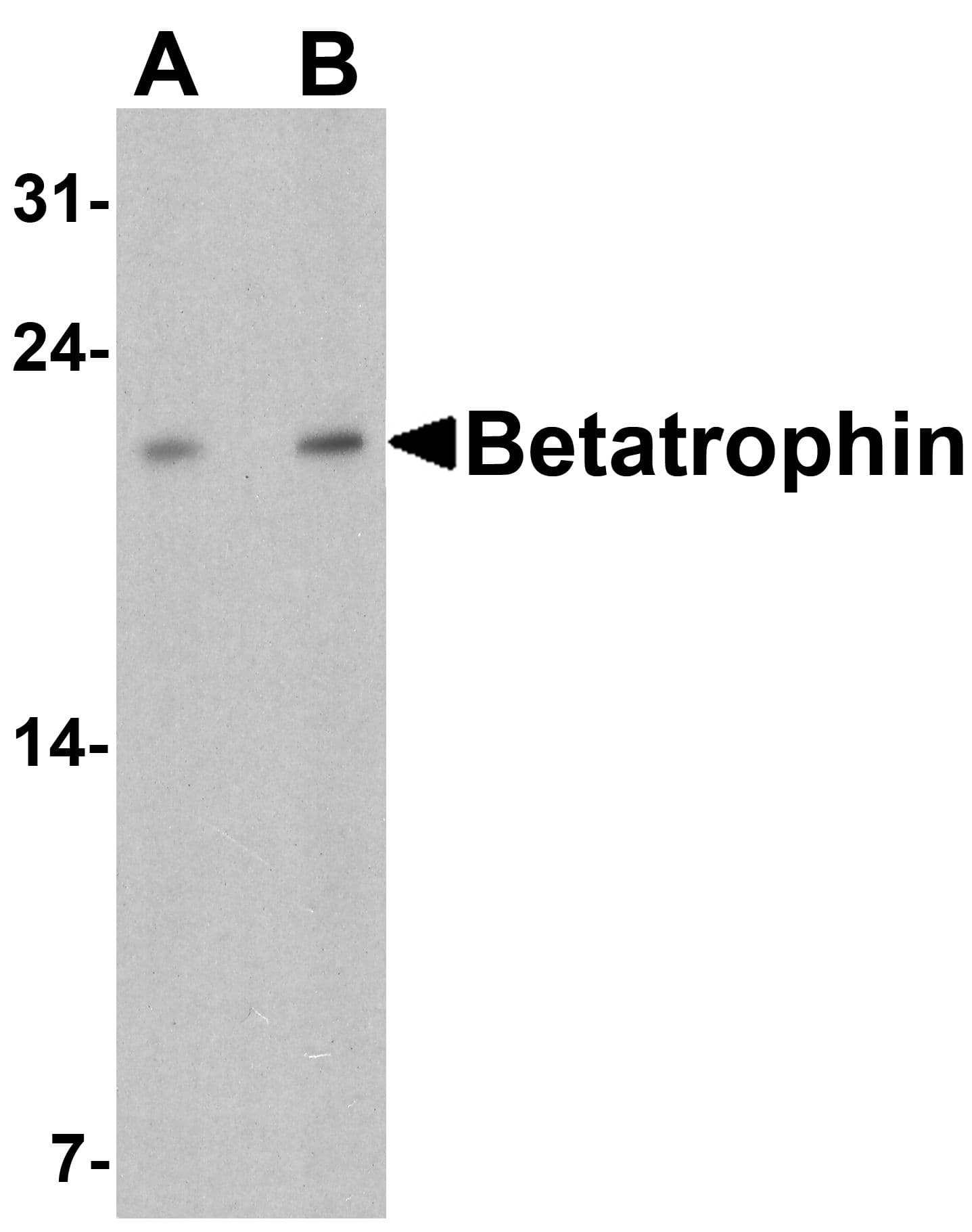 Polyclonal Rabbit anti-Human ANGPTL8 / Betatrophin Antibody (IHC, IF, WB)
