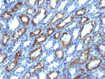 IFN Gamma / Interferon Gamma Antibody (clone IFNG/466)
