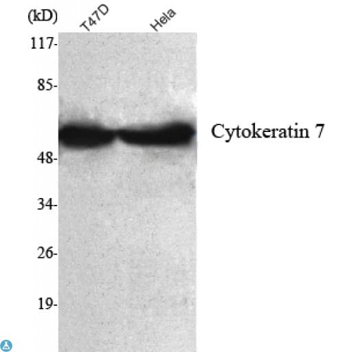KRT7 / CK7 / Cytokeratin 7 Antibody