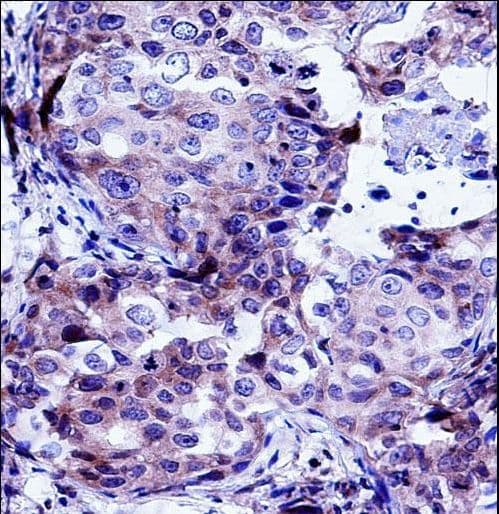 CTTN / Cortactin Antibody (aa273-302)