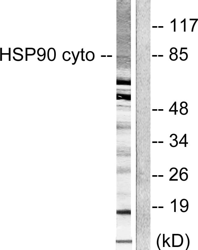 IHC-plus™ HSP90AA1 / Hsp90 Alpha A1 Antibody (aa683-732)