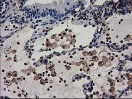 ADSL / Adenylosuccinate Lyase Antibody (clone OTI2D10)
