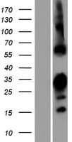 RBPMS2 Protein (Over-Expression Lysate Myc-DDK (Flag))