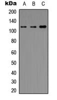Histone Deacetylase HDAC5 / HDAC9 Antibody (Internal)