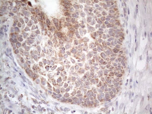 Monoclonal Mouse anti-Human RORB / ROR Beta Antibody (clone OTI1G1, Carrier-free, aa1-260, IHC, WB)