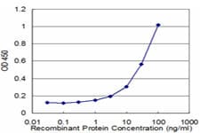 Monoclonal Mouse anti-Human KLK10 / Kallikrein 10 Antibody (clone 1B9, WB)