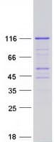 Human PACS2 Protein (Recombinant Myc-DDK (Flag))