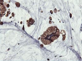PFKP Antibody (clone OTI1A11)
