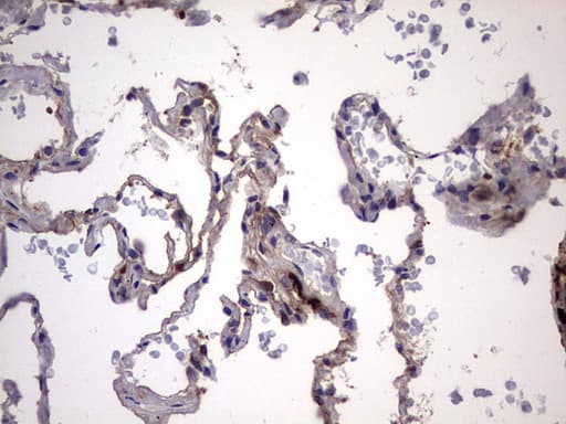 LGALS3 / Galectin 3 Antibody (clone OTI1C7)
