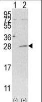 AK4 / Adenylate Kinase 4 Antibody (aa195-223)
