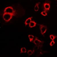 IHC-plus™ CD119 / IFNGR1 Antibody (C-Terminus)