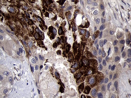 Monoclonal Mouse anti-Human NDUFA4L2 Antibody (clone OTI5C10, Carrier-free, IHC, WB)