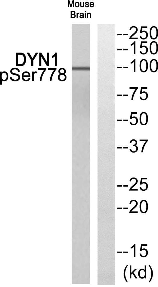 DNM1 / Dynamin Antibody (phospho-Ser778)