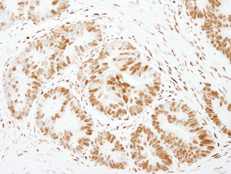FOXK1 / MNF Antibody (aa683-733)