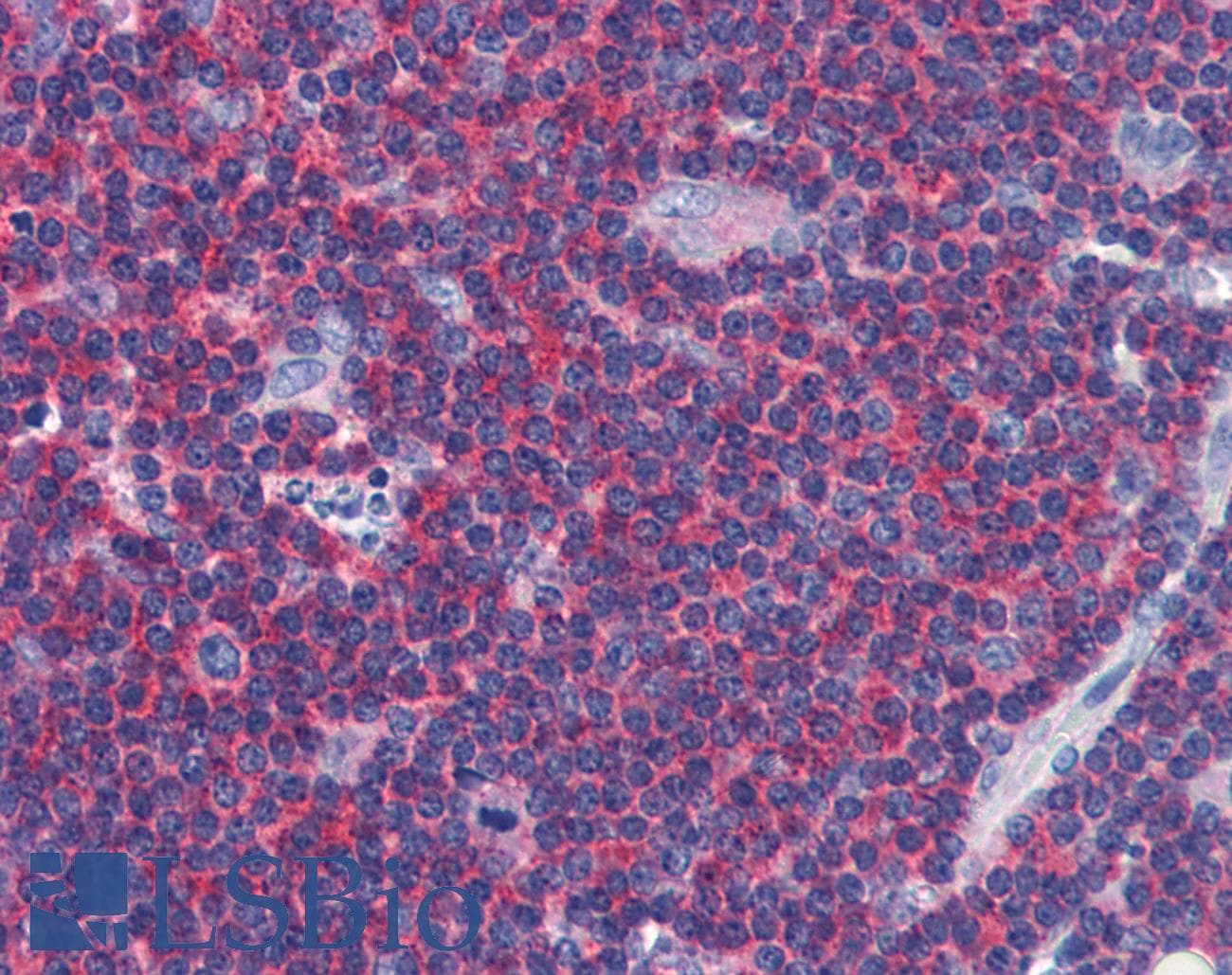 IHC-plus™ ARRB2 / Beta Arrestin 2 Antibody (clone 3G1)