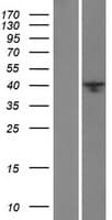 MGC11296 / BRMS1L Protein (Over-Expression Lysate Myc-DDK (Flag))