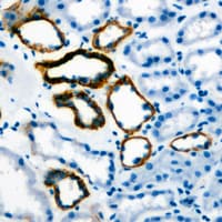 Gastrin Antibody (Internal)