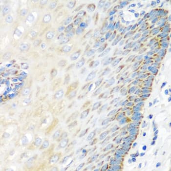 Polyclonal Rabbit anti-Human XIAP Antibody (IHC, IF, WB)