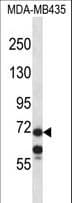 Polyclonal Rabbit anti-Human MID1 Antibody (aa575-603, WB)