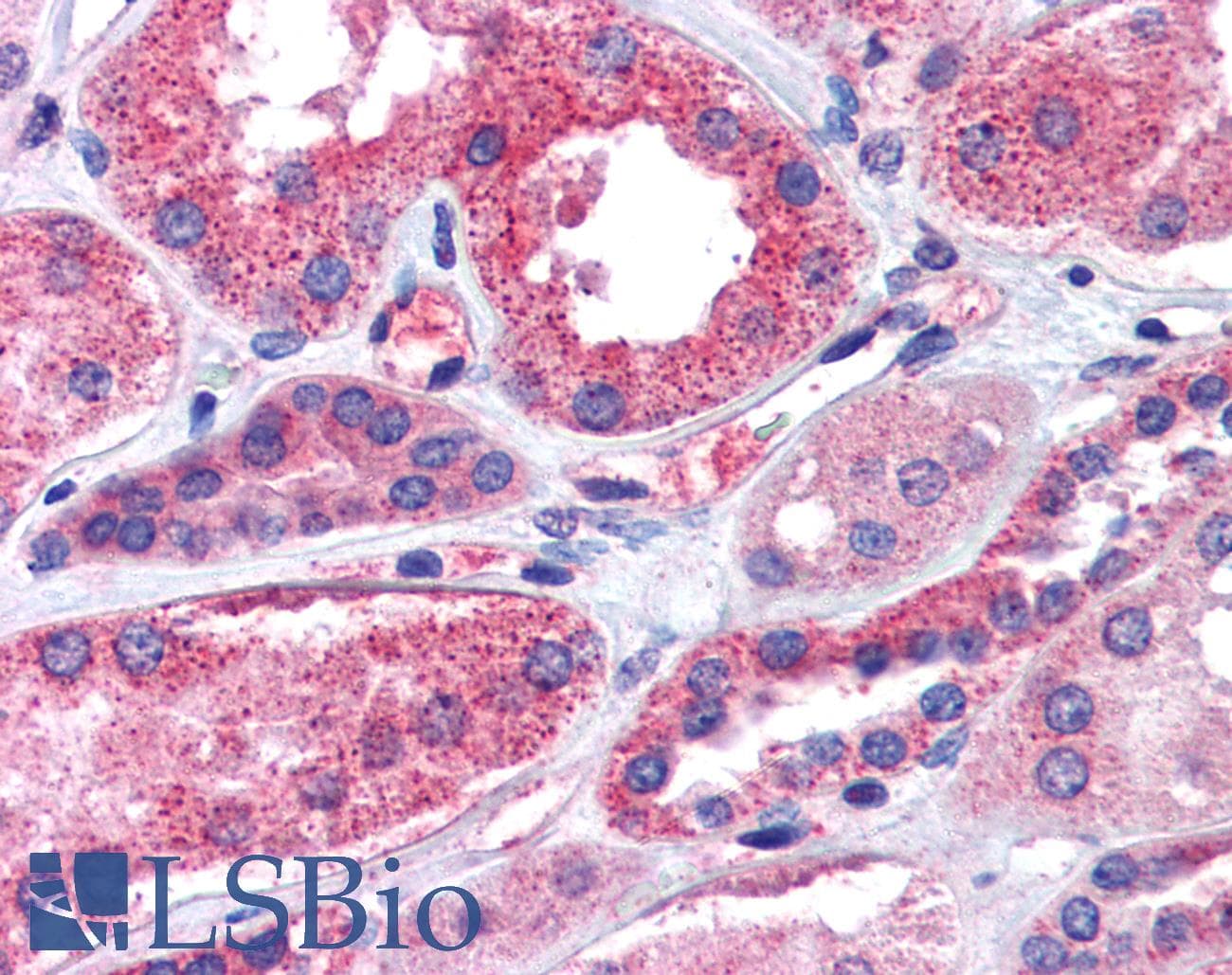 IHC-plus™ CD316 / IGSF8 Antibody (Internal)