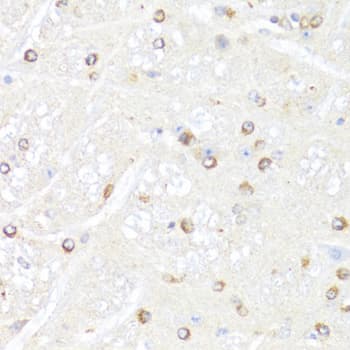 POLR2B / RPB2 Antibody