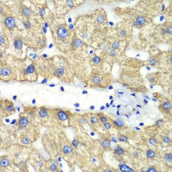 IHC-plus™ ABAT Antibody
