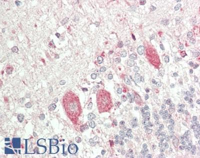 PathPlus™ Polyclonal Rabbit anti-Human PSAP / Prosaposin Antibody (Internal, IHC, WB)