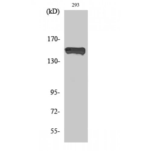 Polyclonal Rabbit anti-Human PLCG1 Antibody (720-800 aa, IHC, WB)