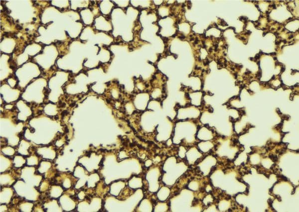 Polyclonal Rabbit anti-Human PER2 Antibody (IHC, IF, WB)