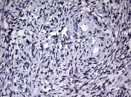NBN / Nibrin Antibody (aa183-460, clone OTI3C12, Carrier-free)